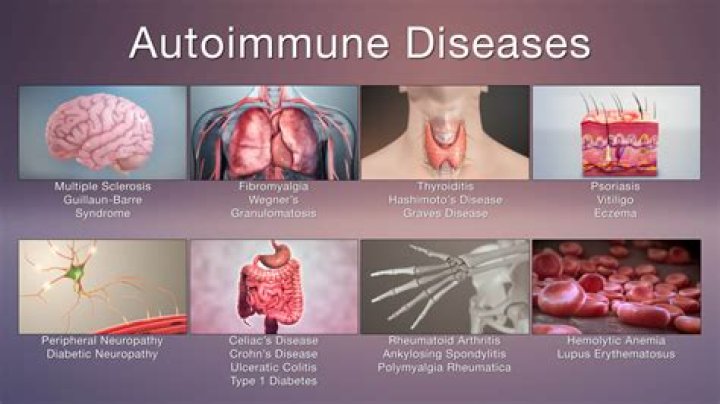 Are autoimmune diseases caused by parasites?