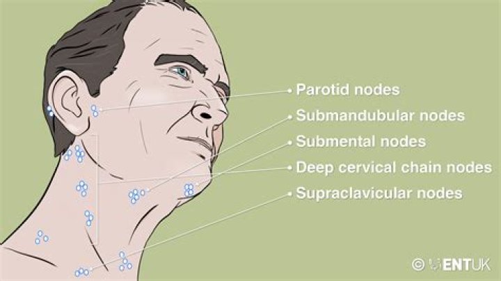 Are lymph nodes movable?