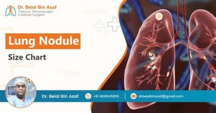 At what size should a lung nodule be removed?