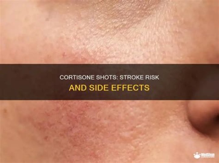 Can a cortisone shot cause a stroke?