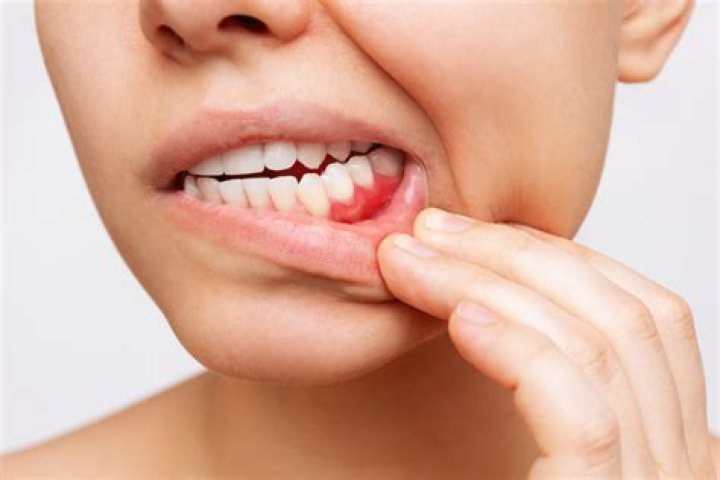 Can a infected tooth make you sick?