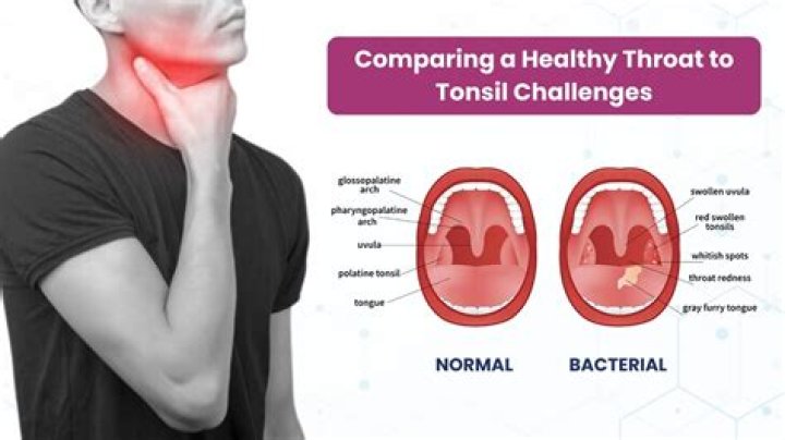 Can Alexa track my snoring?