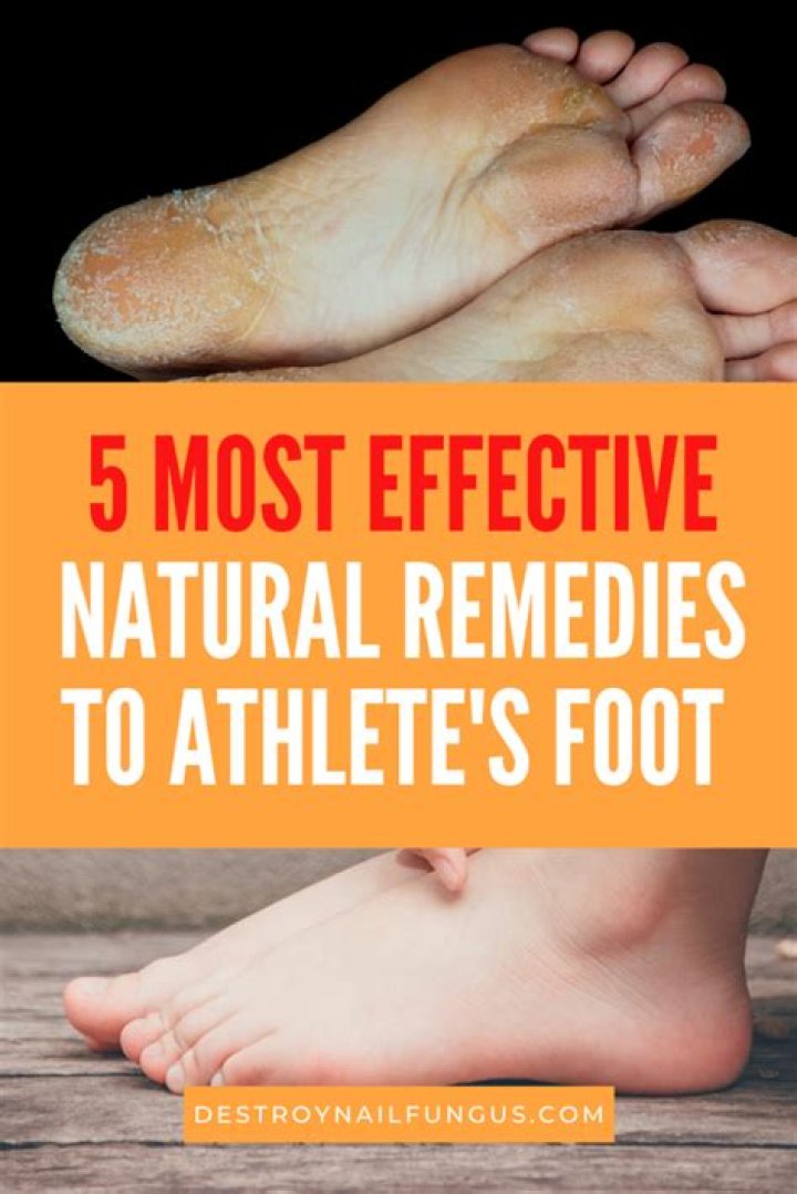 Can athlete's foot go away on its own?