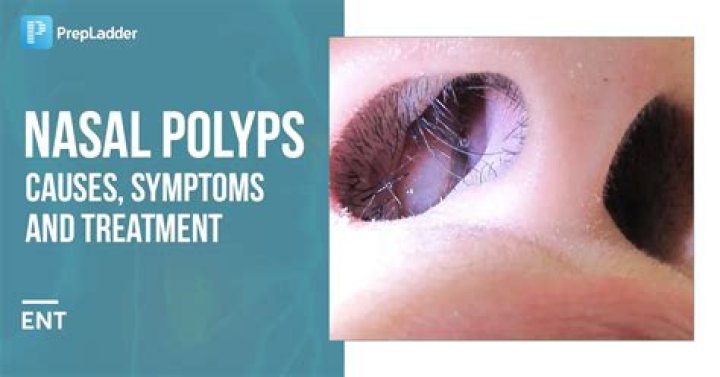 Can black mold cause nasal polyps?