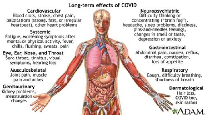 Can Covid cause muscle and joint pain?