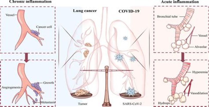 Can Covid cause permanent lung damage?