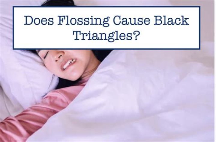 Can flossing cause black triangles?