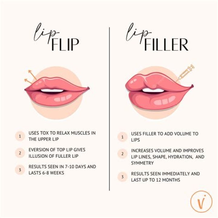 Can I kiss after a lip flip?