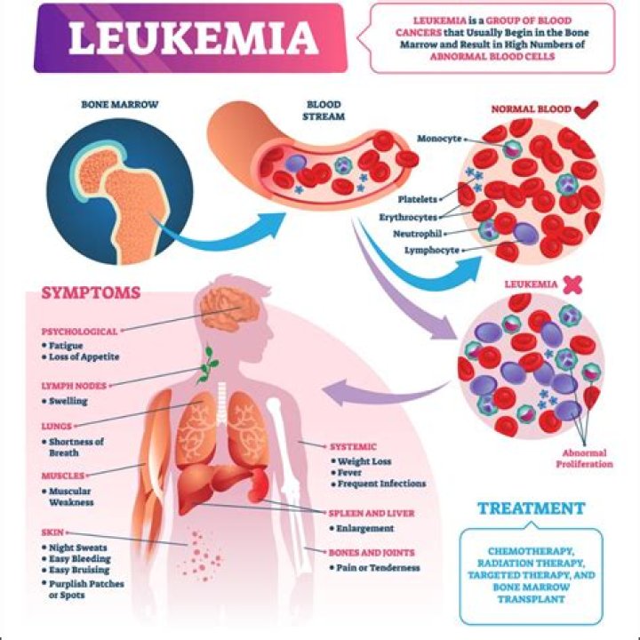 Can leukemia be caused by stress?