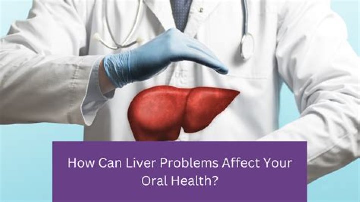 Can liver problems affect your mouth?