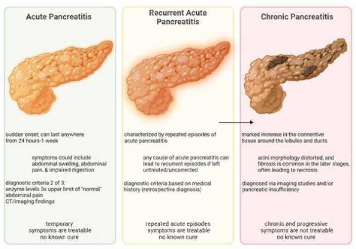 Can pancreatitis go undetected?