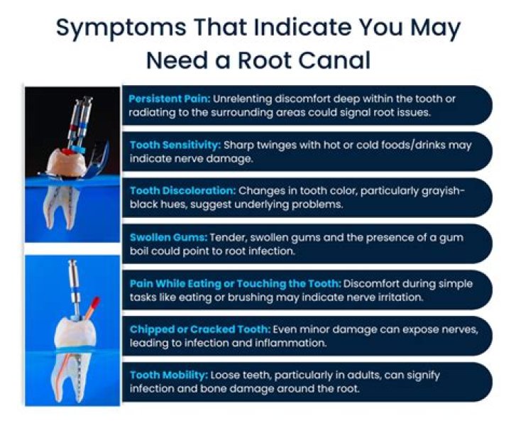 Can root canal damage nerves?