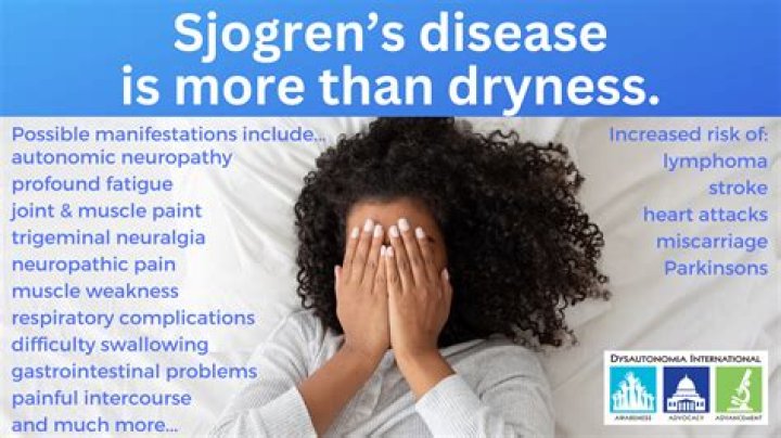 Can sjogrens go into remission?