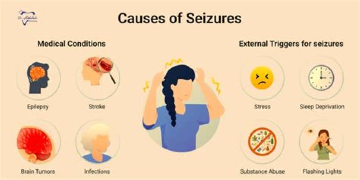 Can stress cause seizure like symptoms?