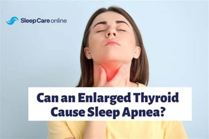 Can thyroid affect sleep?
