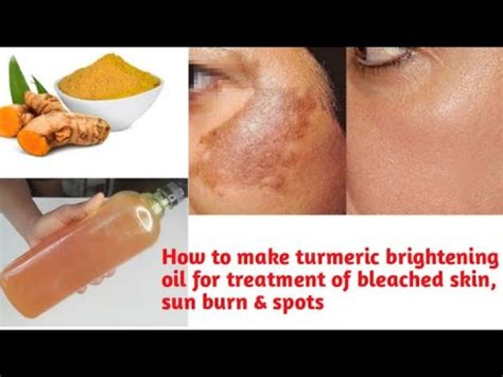 Can turmeric burn skin?