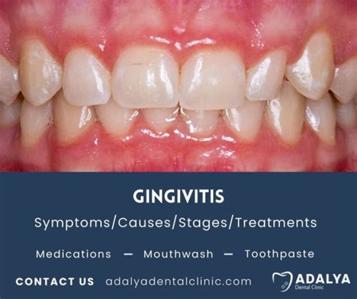 Can you reverse gingivitis at home?