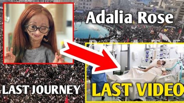 Did Adalia Rose pass away 2021?