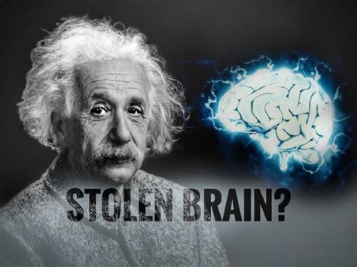 Did Albert Einstein have his brain stolen?