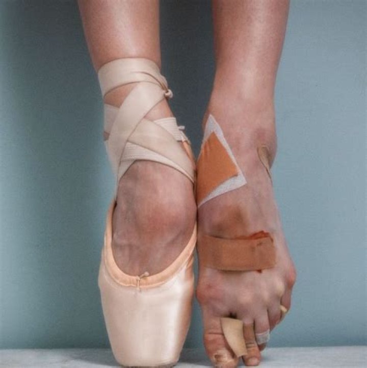 Do ballerinas have broad shoulders?