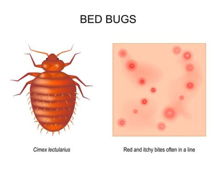 Do bed bugs bite in your hair?