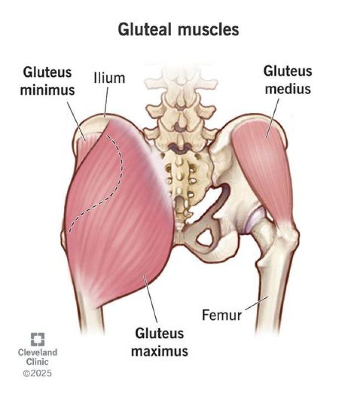 Do I have weak glutes?