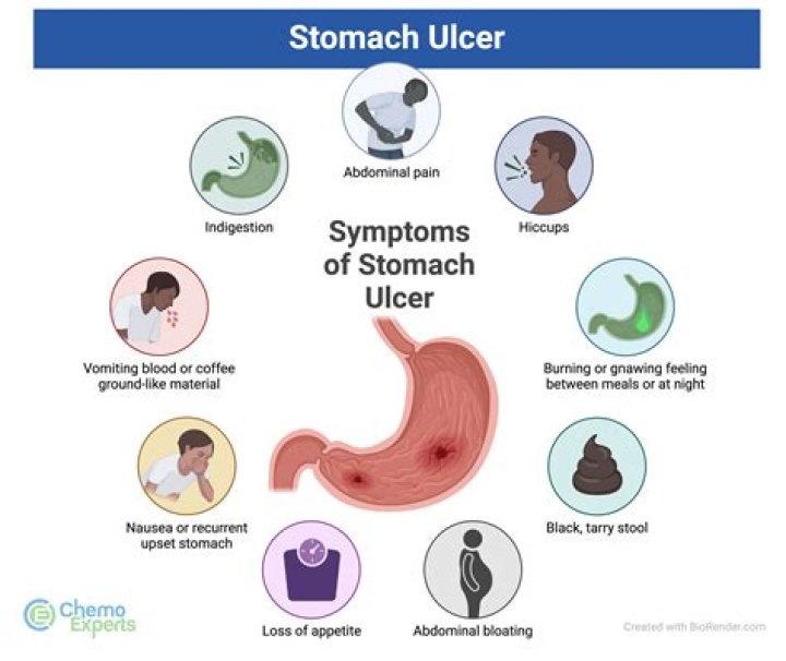 Do ulcers feel like hunger pains?