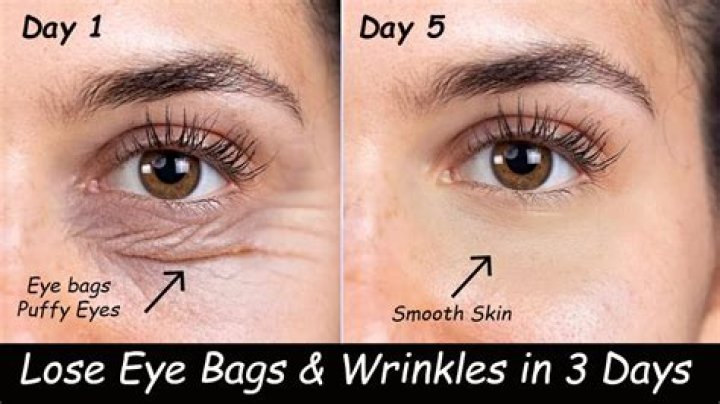 Does Bag Balm help wrinkles?