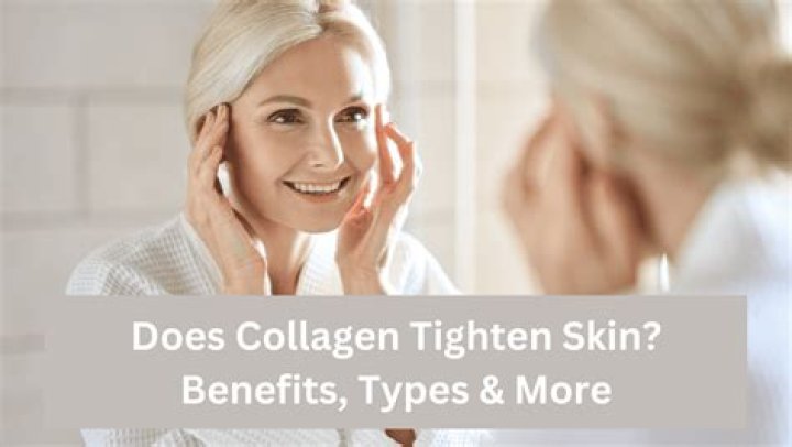 Does collagen tighten skin?