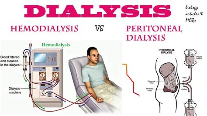 Does dialysis affect you mentally?