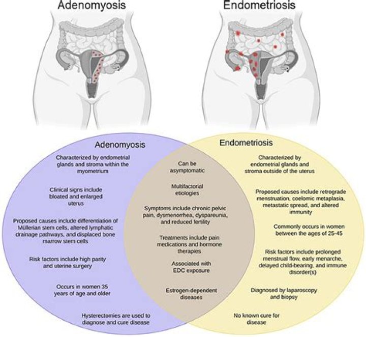 Does endometriosis pain happen everyday?