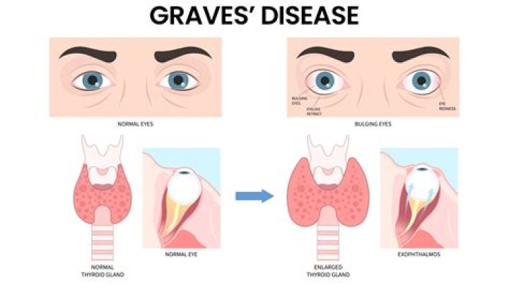 Does Graves become Grindelwald?