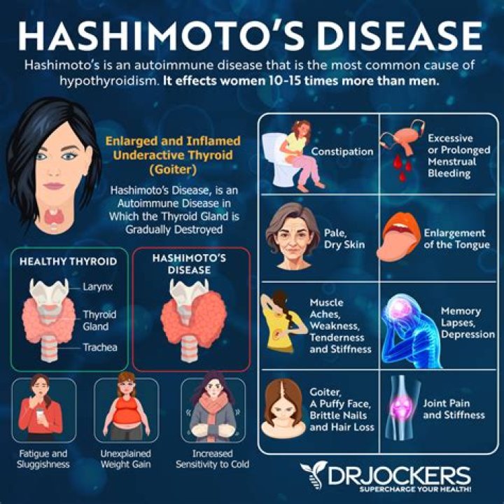 Does Hashimoto's cause tooth loss?