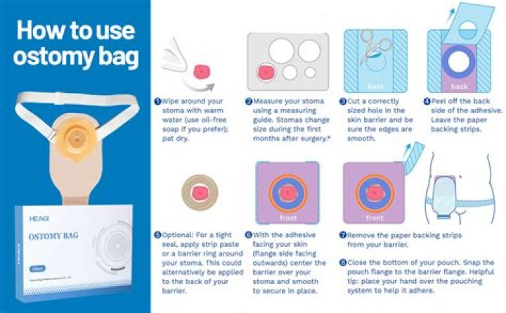 Does having a stoma make you tired?