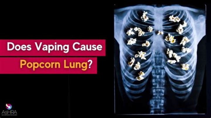 Does Japan have popcorn?