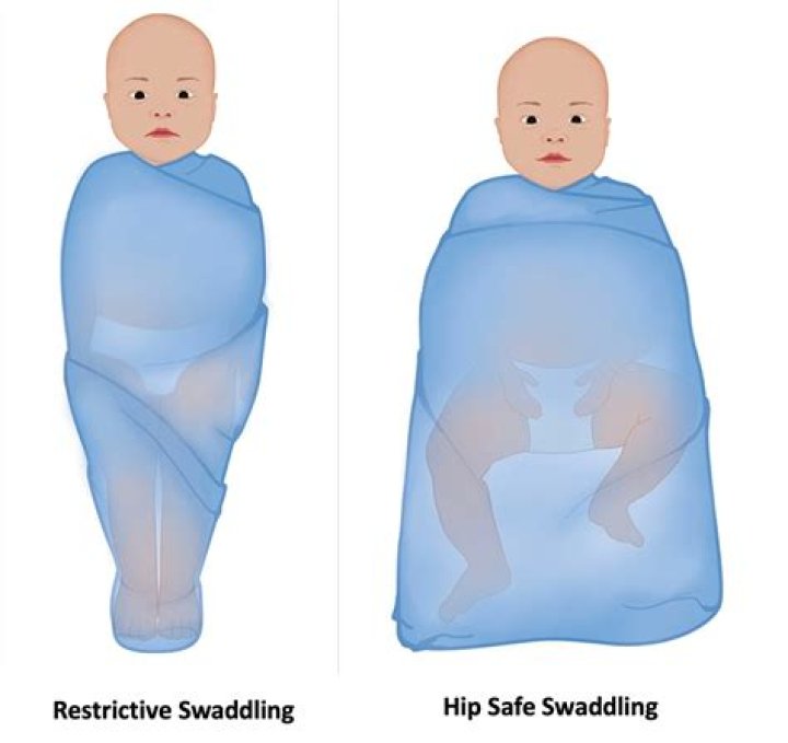 Does swaddling help reflux?