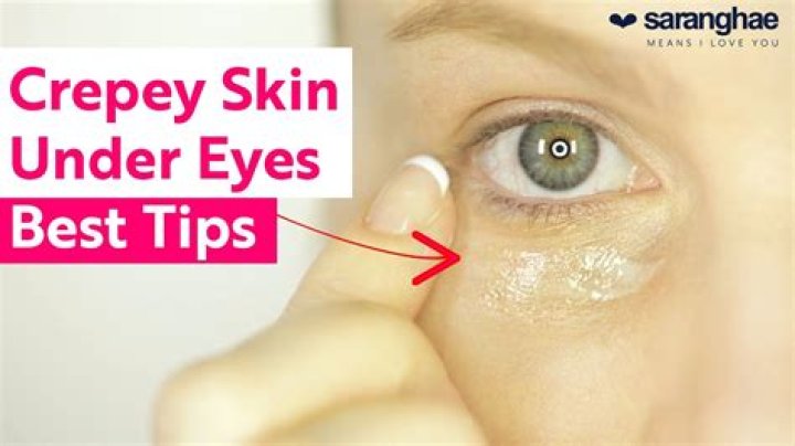 How can I improve my Crepey eyelids?