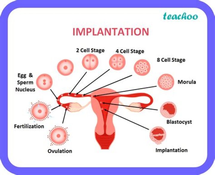 How can I make sure my implantation is successful?