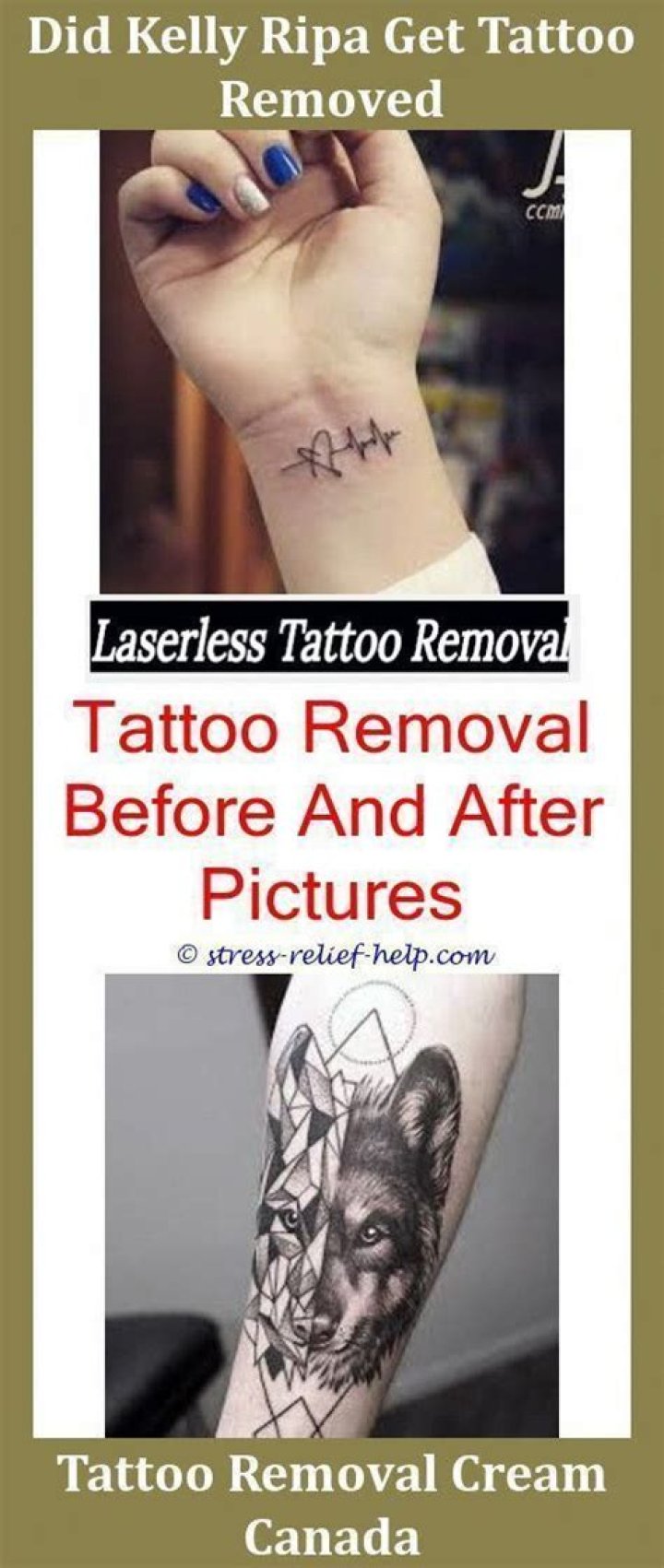 How can I remove a tattoo at home?