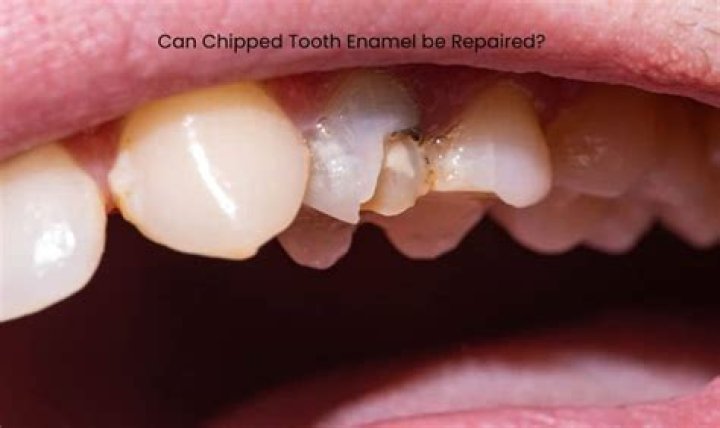 How can I restore my enamel?