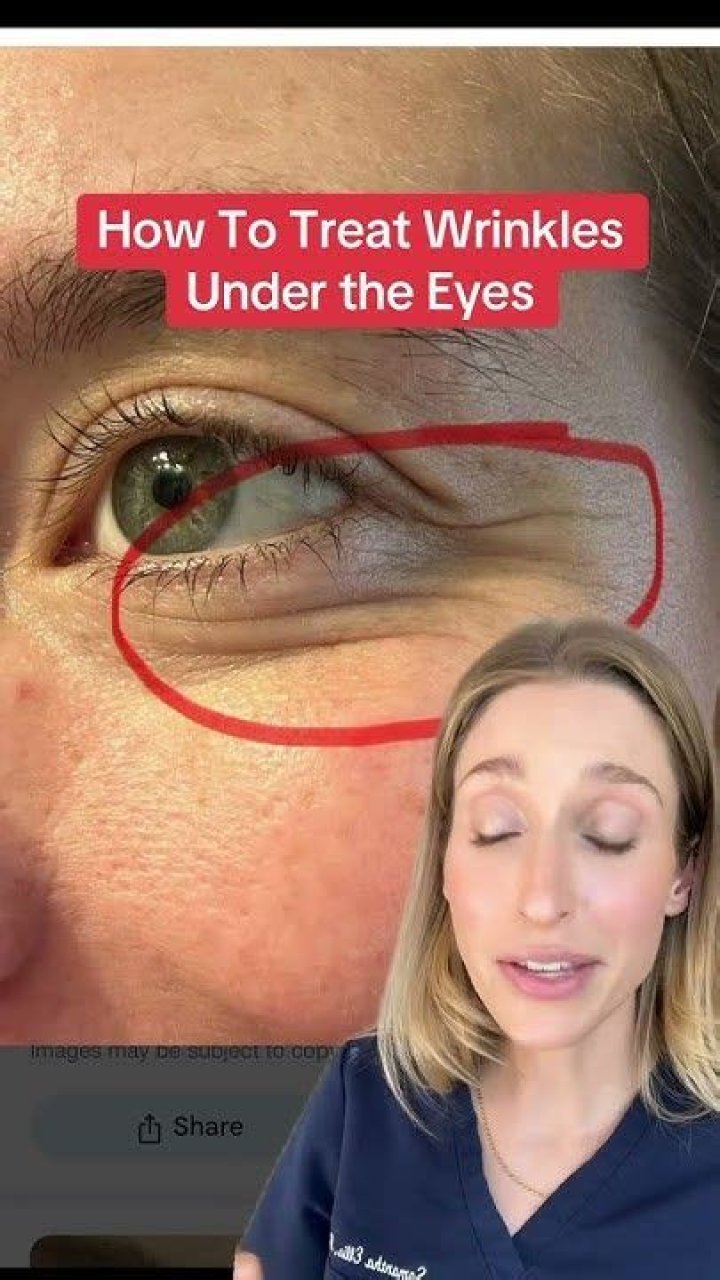 How can I soften under eye wrinkles?