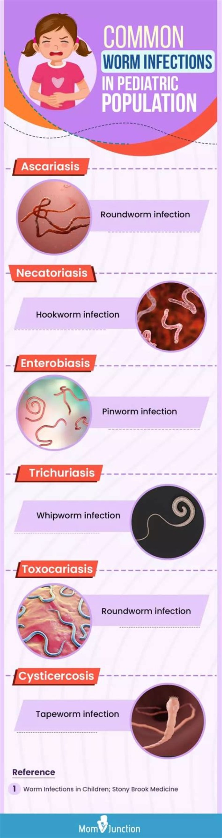 How common are pinworms in us?