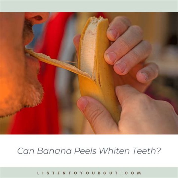 How do banana peels whiten teeth?