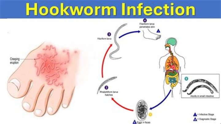 How do I disinfect my house from hookworms?