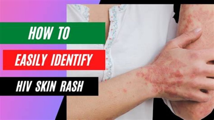 How do I identify a rash?