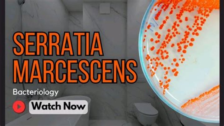 How do I know if I have Serratia marcescens?