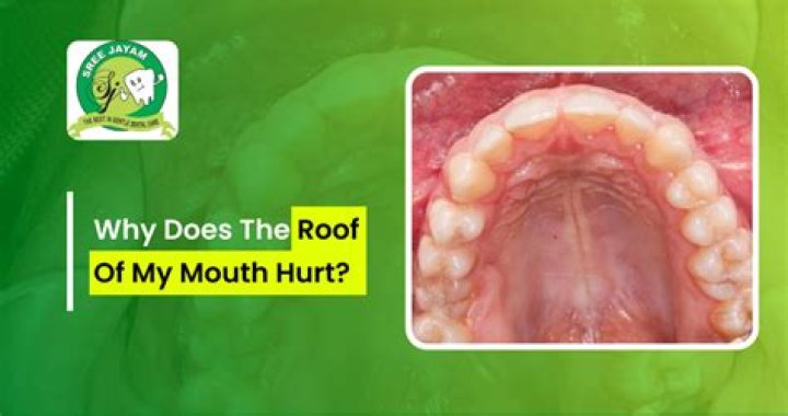 How do I stop pushing my tongue to the roof of my mouth?