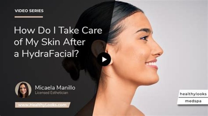 How do I take care of my skin after a HydraFacial?
