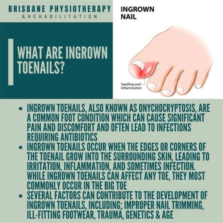 How do you deal with nasty neighbors?