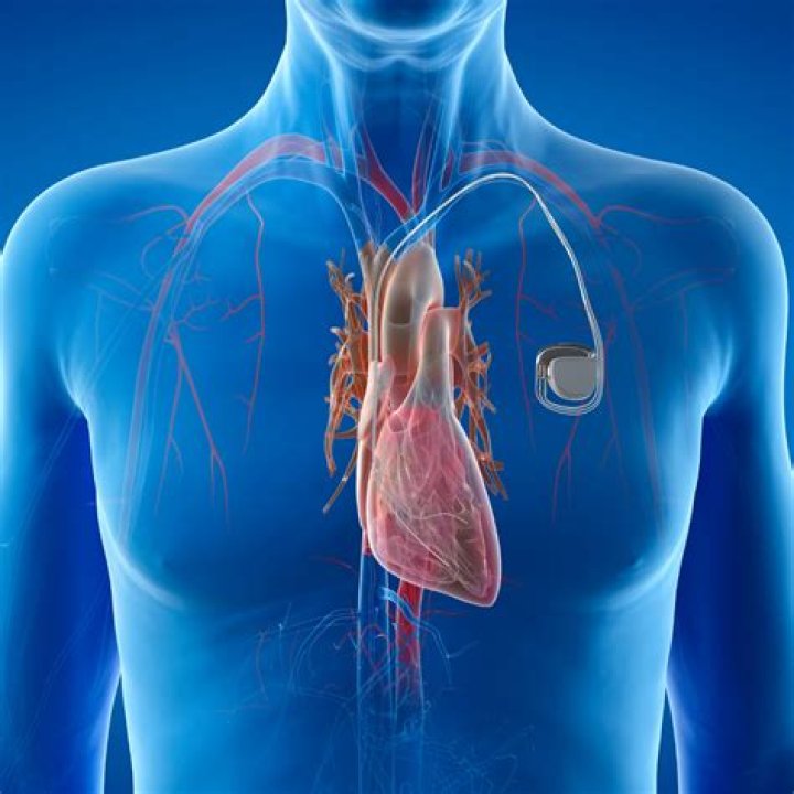 How do you get placed in Dell?